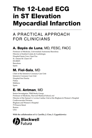 The 12 Lead ECG in ST Elevation Myocardial Infarction: A Practical Approach for Clinicians