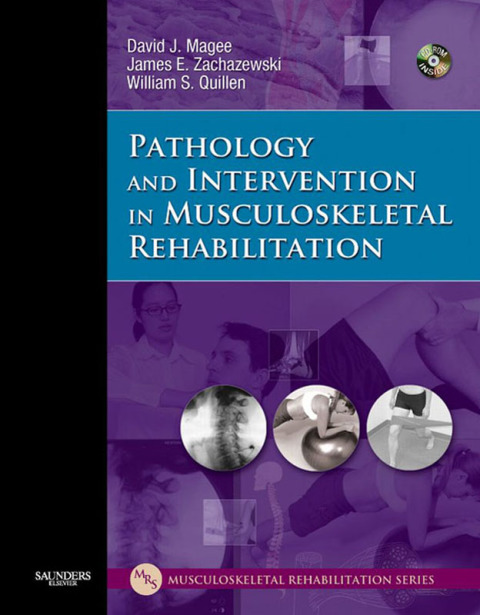 Pathology and Intervention in Musculoskeletal Rehabilitation 