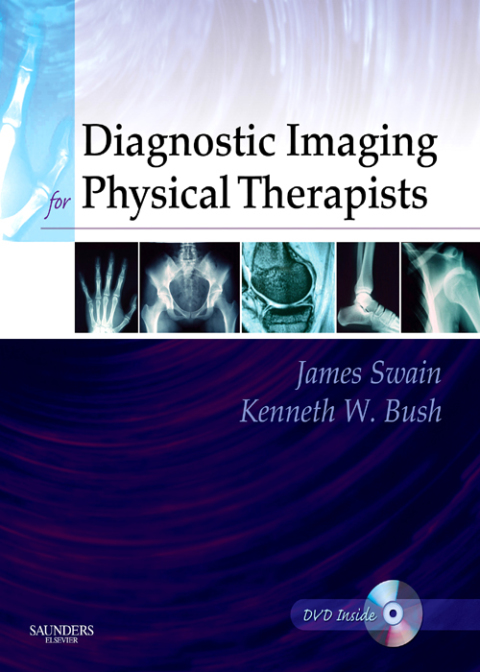 Cover image for book Diagnostic Imaging for Physical Therapists