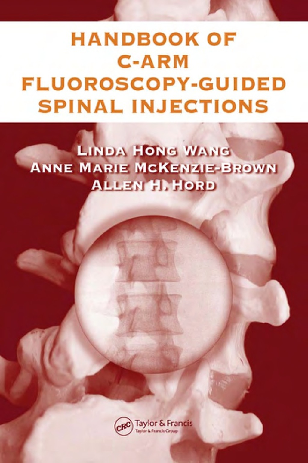 The Handbook of C-Arm Fluoroscopy-Guided Spinal Injections (eBook Rental) The Handbook of C-Arm Fluoroscopy-Guided Spinal Injections (eBook Rental)