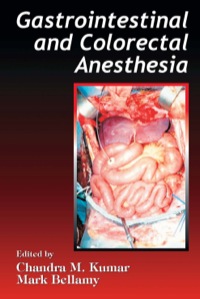 Titelbild: Gastrointestinal and Colorectal Anesthesia 1st edition 9780849340734