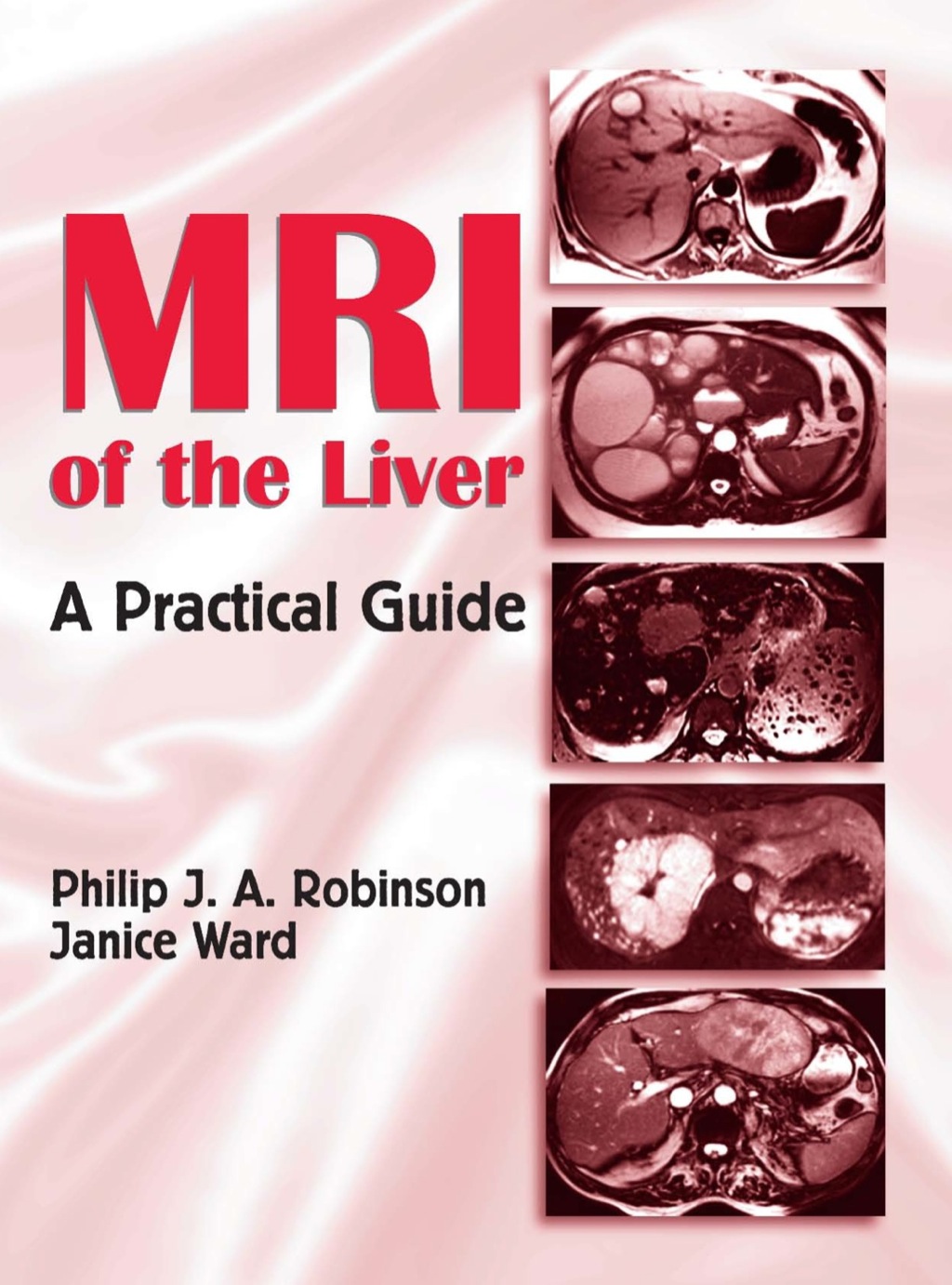 MRI of the Liver - 1st Edition (eBook)