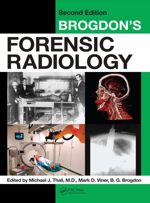 Cover image for book Brogdon's Forensic Radiology