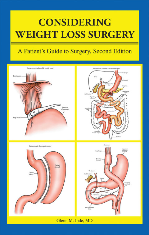 Cover image for book Considering Weight Loss Surgery