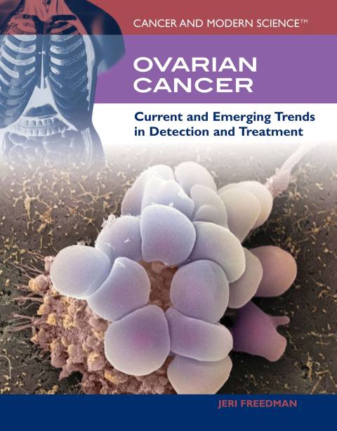 Cover image for book Ovarian Cancer