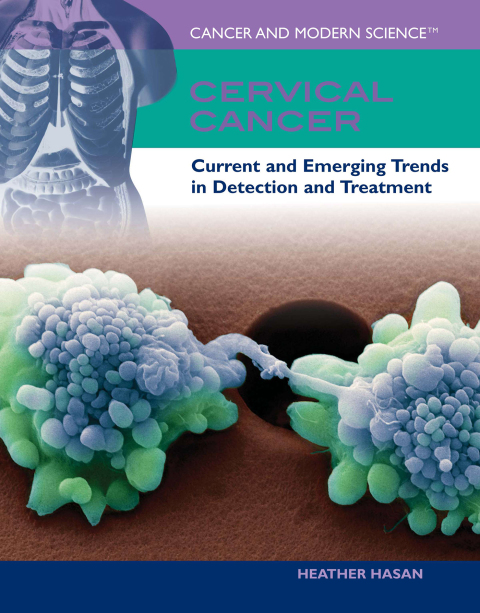 Cover image for book Cervical Cancer
