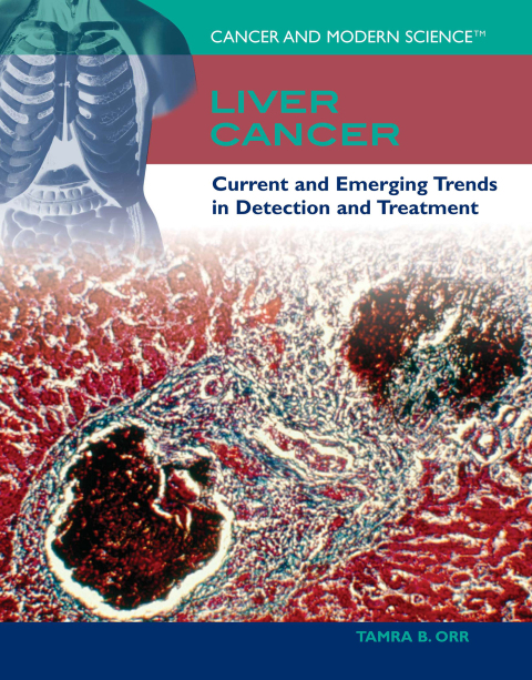 Cover image for book Liver Cancer