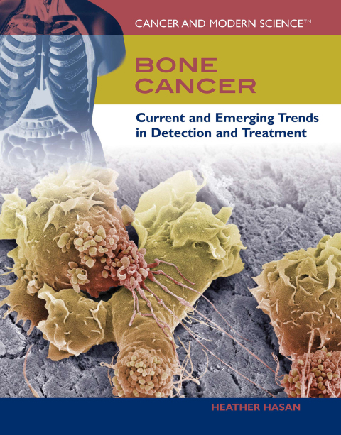 Cover image for book Bone Cancer