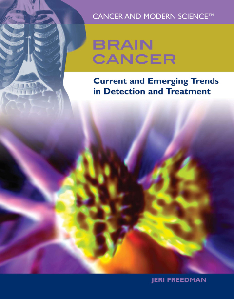 Cover image for book Brain Cancer