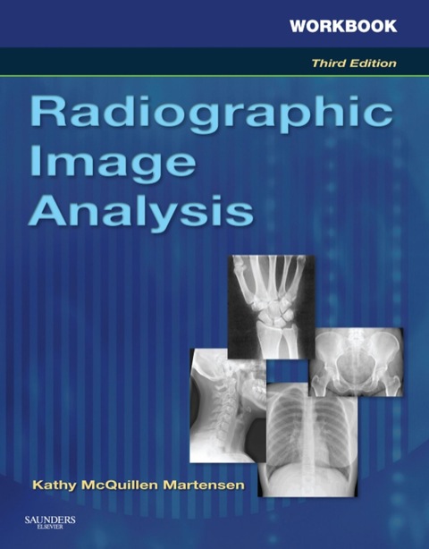 Cover image for book Radiographic Image Analysis (Workbook)