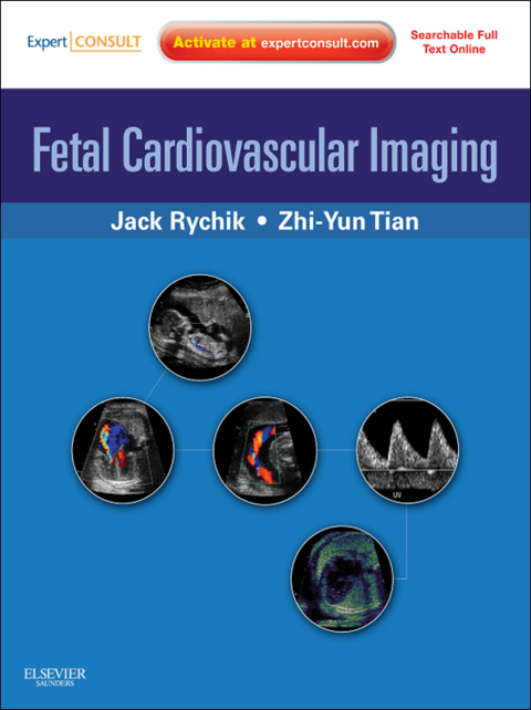 Cover image for book Fetal Cardiovascular Imaging