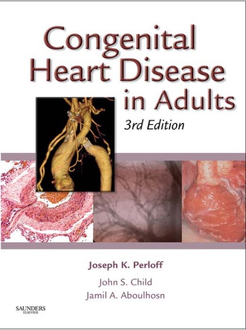 Cover image for book Congenital Heart Disease in Adults
