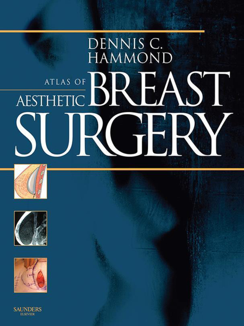 Atlas of Aesthetic Breast Surgery 