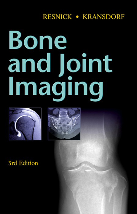 Cover image for book Bone and Joint Imaging