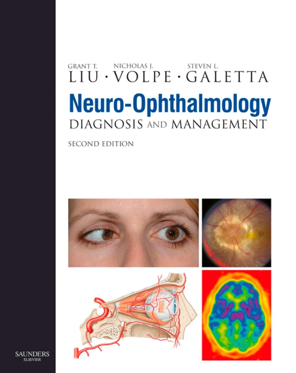 Neuro-Ophthalmology E-Book (eBook) - Grant T. Liu; Nicholas J. Volpe; Steven L. Galetta