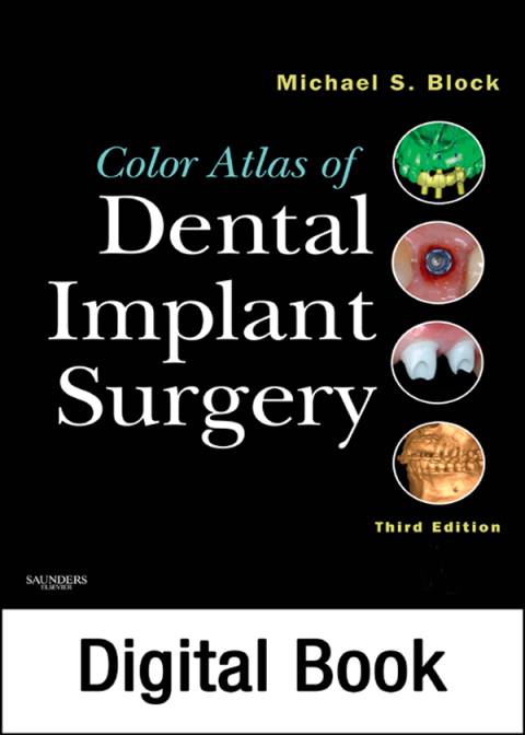 Color Atlas of Dental Implant Surgery 
