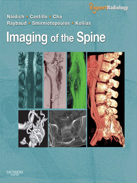 Cover image for book Imaging of the Spine