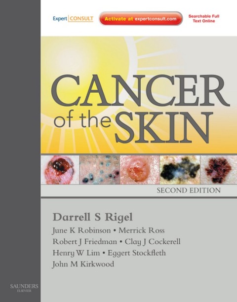 Cancer of the Skin 