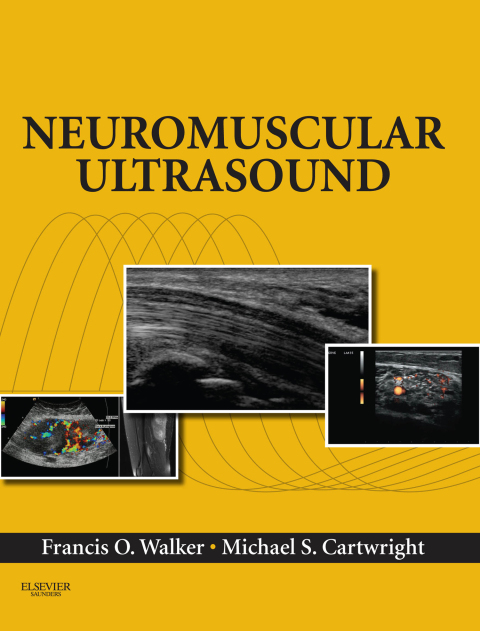 Neuromuscular Ultrasound 