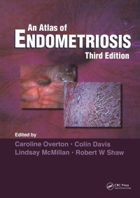 Titelbild: Atlas of Endometriosis 3rd edition 9780415395731
