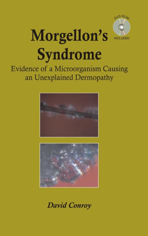 Cover image for book Morgellon's Syndrome