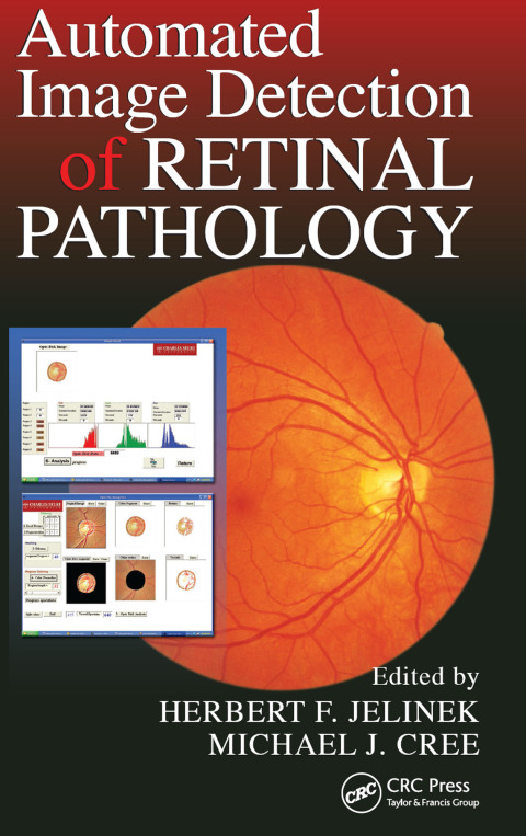 Cover image for book Automated Image Detection of Retinal Pathology