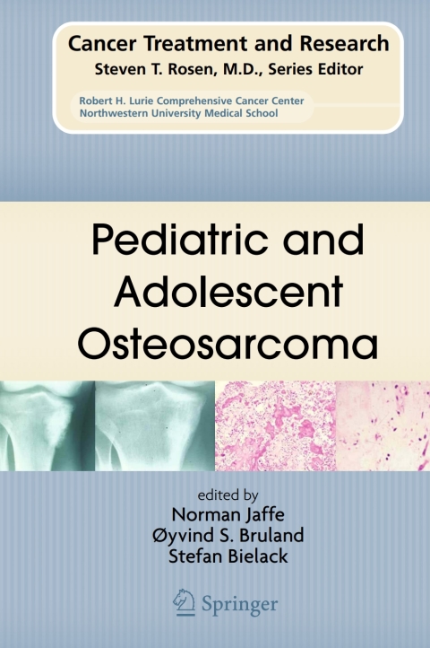 Cover image for book Pediatric and Adolescent Osteosarcoma