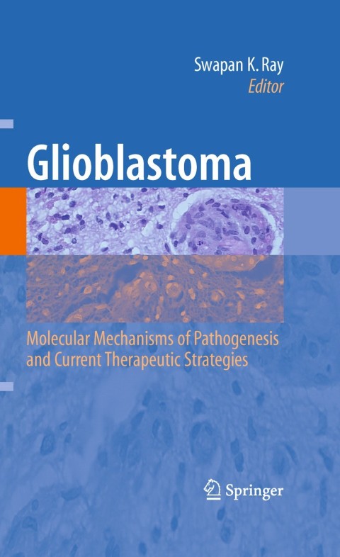 Cover image for book Glioblastoma: