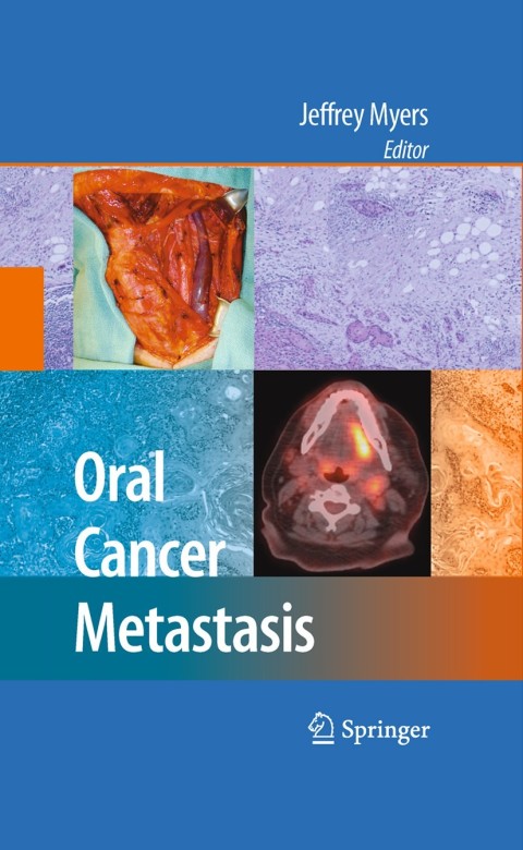 Cover image for book Oral Cancer Metastasis