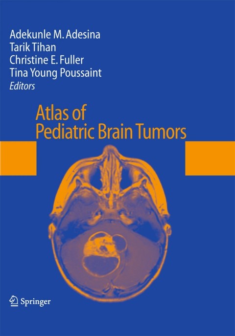 Cover image for book Atlas of Pediatric Brain Tumors