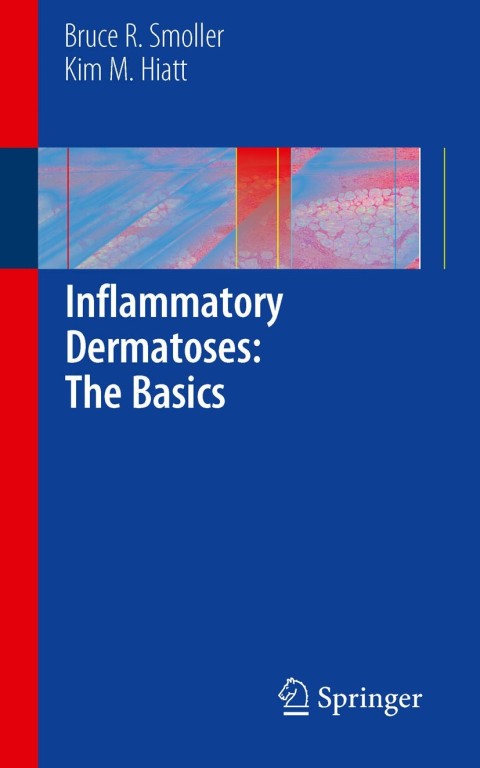 Cover image for book Inflammatory Dermatoses: The Basics
