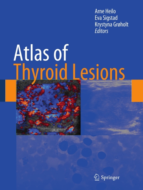 Cover image for book Atlas of Thyroid Lesions