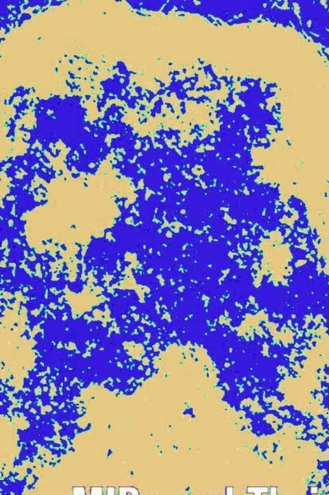 Cover image for book MIPs and Their Roles in the Exchange of Metalloids