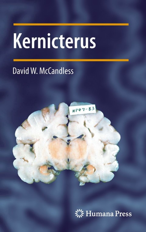Cover image for book Kernicterus