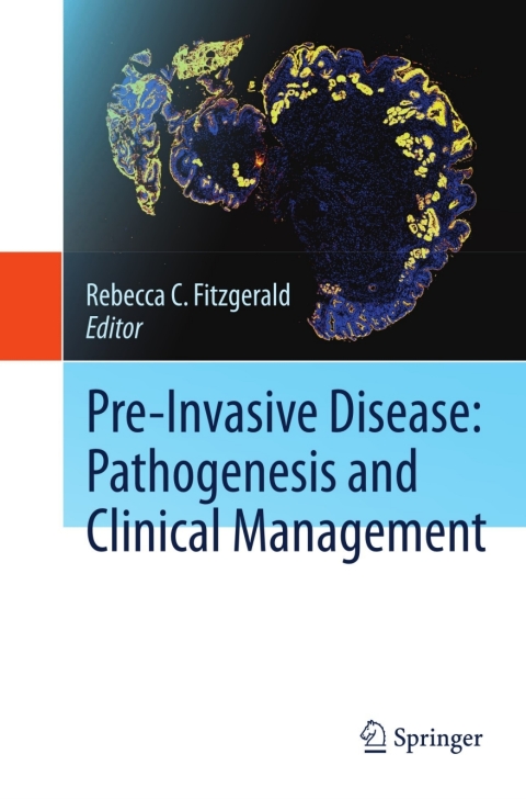 Cover image for book Pre-Invasive Disease: Pathogenesis and Clinical Management
