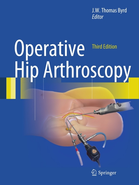 Cover image for book Operative Hip Arthroscopy