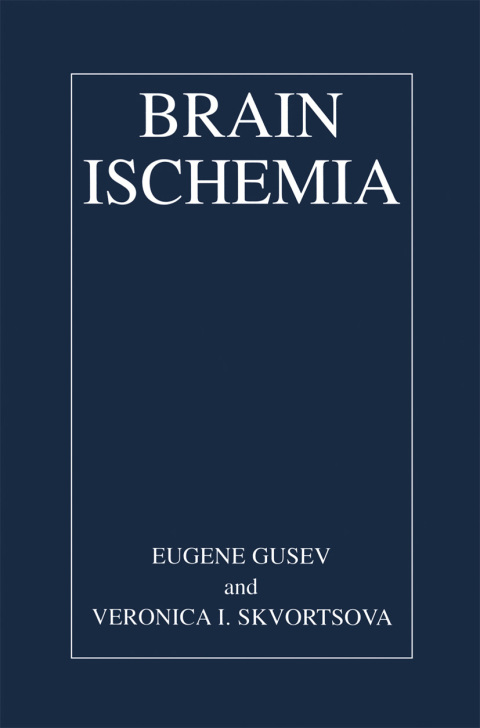 Cover image for book Brain Ischemia