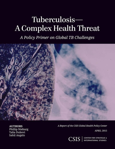 Cover image for book Tuberculosis—A Complex Health Threat