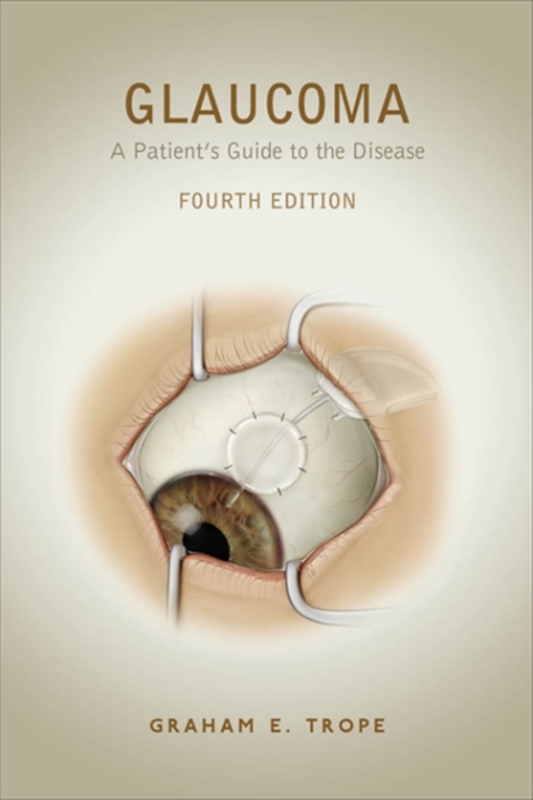 Cover image for book Glaucoma