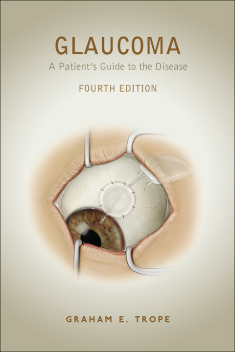 Cover image for book Glaucoma