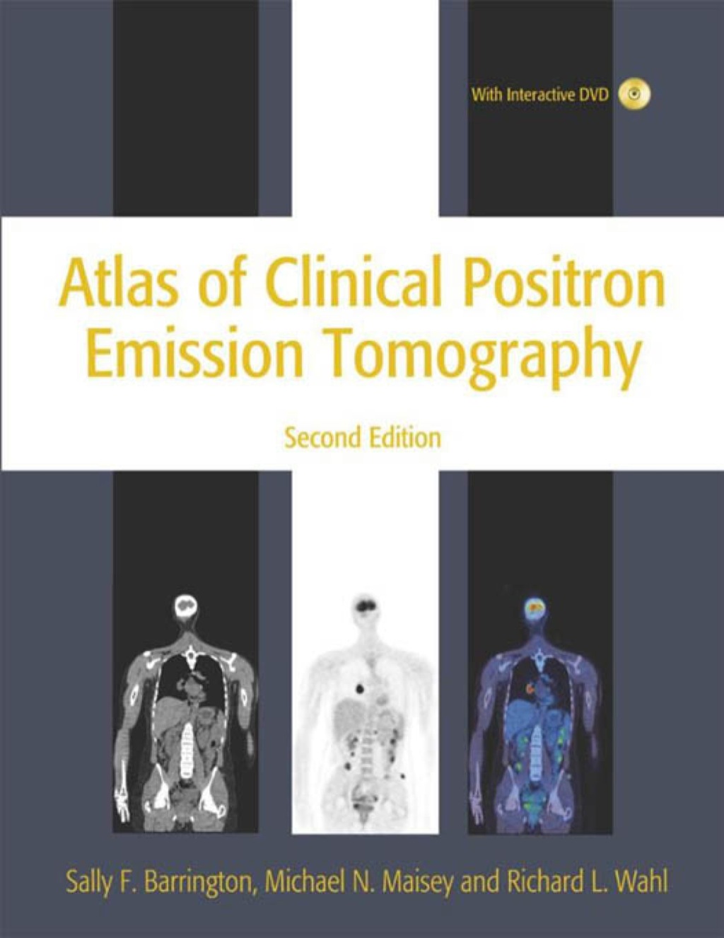 Atlas of Clinical Positron Emission Tomography (eBook) - Sally Barrington