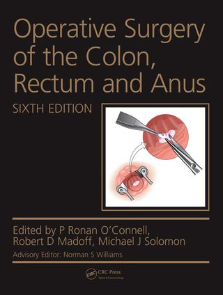 Operative Surgery of the Colon, Rectum and Anus