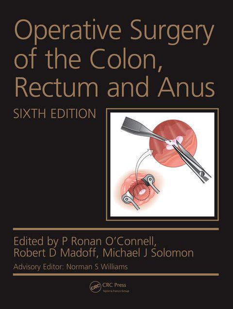 Cover image for book Operative Surgery of the Colon, Rectum and Anus