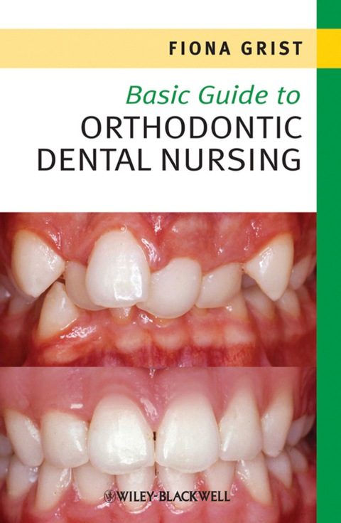 Cover image for book Basic Guide to Orthodontic Dental Nursing