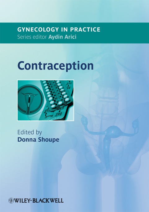 Cover image for book Contraception