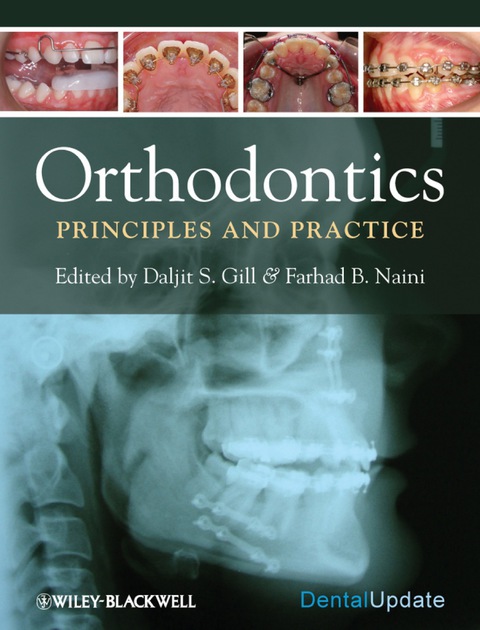 Cover image for book Orthodontics: Principles and Practice