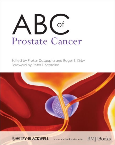 ABC of Prostate Cancer 