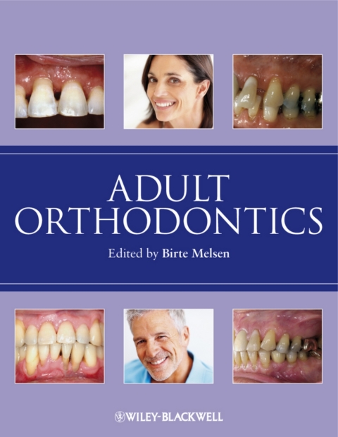 Cover image for book Adult Orthodontics