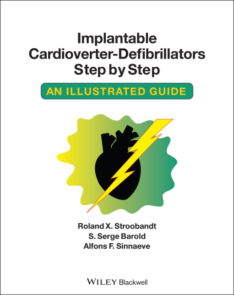 Cover image for book Implantable Cardioverter - Defibrillators Step by Step