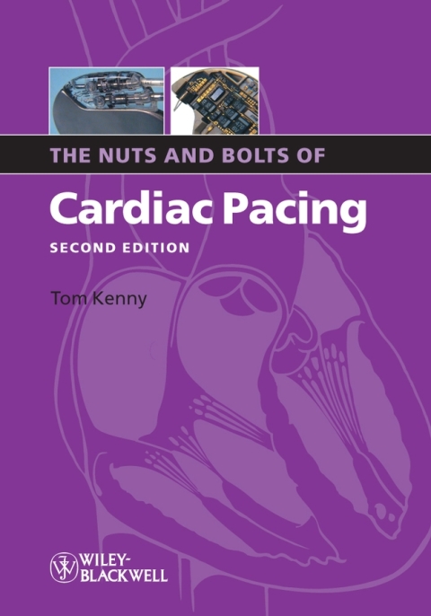 The Nuts and Bolts of Cardiac Pacing 